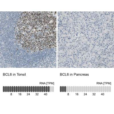 Immunohistochemistry-Paraffin: Bcl-6 Antibody [NBP2-59786]