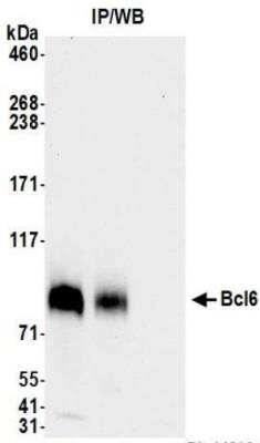 Immunoprecipitation: Bcl-6 Antibody (BLR143H) [NBP3-14723]