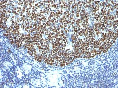 Immunohistochemistry-Paraffin: Bcl-6 Antibody (SPM602) - Azide and BSA Free [NBP3-08851]