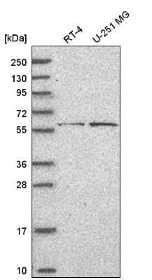 Western Blot: Bcl-6 Antibody [NBP2-76541]