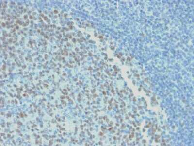 Immunohistochemistry-Paraffin: Bcl-6 Antibody (rBCL6/1718) - Azide and BSA Free [NBP3-08834]