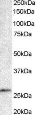 Western Blot: Bcl 7A Antibody [NB100-769]