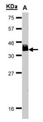 Western Blot: Bcl 7A Antibody [NBP1-30941]