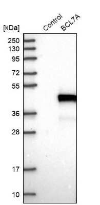 Western Blot: Bcl 7A Antibody [NBP1-91696]