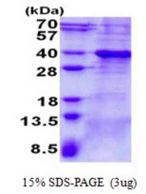 SDS-PAGE: Recombinant Human Bcl 7A His Protein [NBP2-22707]