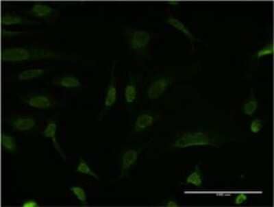 Immunocytochemistry/ Immunofluorescence: Bcl-9 Antibody (1A2) [H00000607-M02]