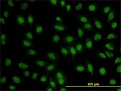 Immunocytochemistry/ Immunofluorescence: Bcl-9 Antibody (2D4) [H00000607-M01]