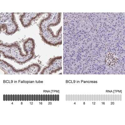 Immunohistochemistry-Paraffin: Bcl-9 Antibody [NBP2-30472]