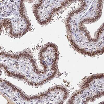 Immunohistochemistry-Paraffin: Bcl-9 Antibody [NBP2-30472]
