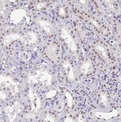 Immunohistochemistry-Paraffin: Bcl-9 Antibody [NBP2-30472]