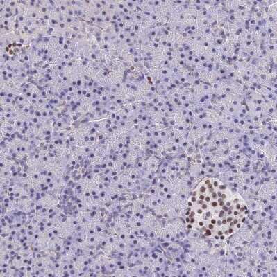Immunohistochemistry-Paraffin: Bcl-9 Antibody [NBP2-30472]