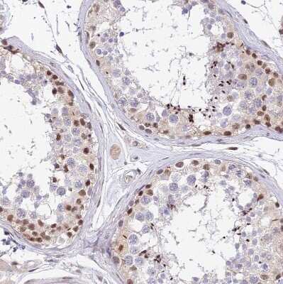 Immunohistochemistry-Paraffin: Bcl-9 Antibody [NBP2-30472]