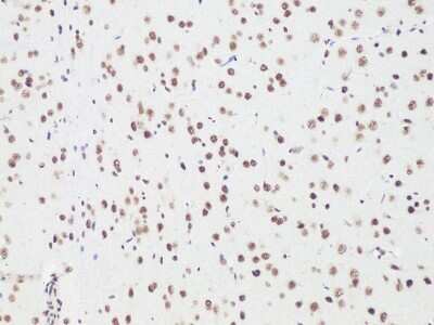 Immunohistochemistry-Paraffin: Bcl-9 Antibody - BSA Free [NBP3-05612]