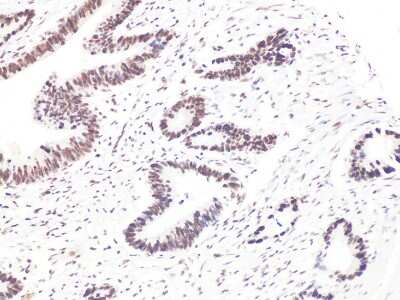 Immunohistochemistry-Paraffin: Bcl-9 Antibody - BSA Free [NBP3-05612]