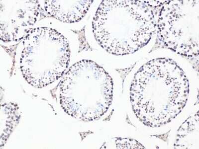 Immunohistochemistry-Paraffin: Bcl-9 Antibody - BSA Free [NBP3-05612]