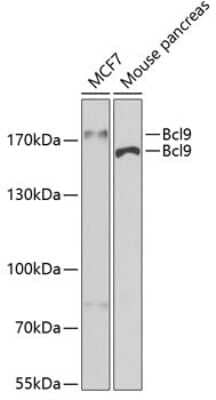 Western Blot: Bcl-9 AntibodyBSA Free [NBP3-05612]