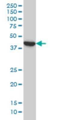 Western Blot: Bcl G Antibody (1F2) [H00079370-M01]