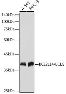 Western Blot: Bcl G Antibody (6R9F3) [NBP3-15746]