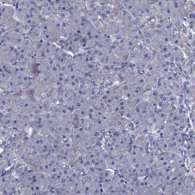 Immunohistochemistry-Paraffin: Bcl G Antibody [NBP1-91697]
