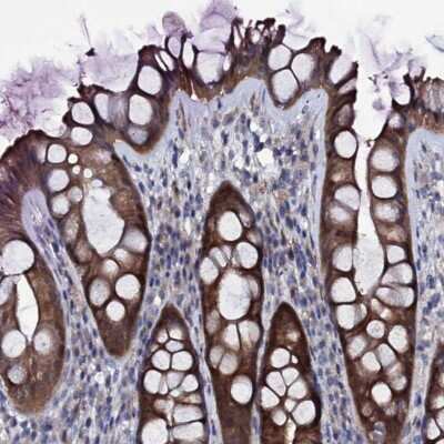 Immunohistochemistry-Paraffin: Bcl G Antibody [NBP1-91697]