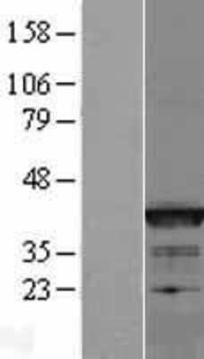 Western Blot: Bcl G Overexpression Lysate [NBP2-05634]