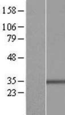 Western Blot: Bcl G Overexpression Lysate [NBP2-05635]