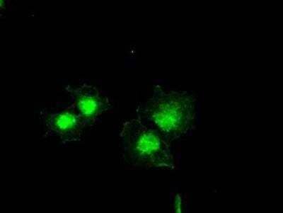 Immunocytochemistry/ Immunofluorescence: Bcl-xL Antibody (OTI4A9) [NBP1-47665]