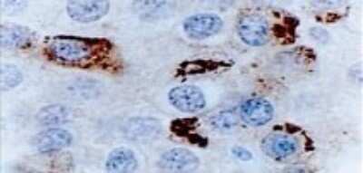 Immunohistochemistry-Paraffin: Bcl-xL Antibody [NB100-56104]