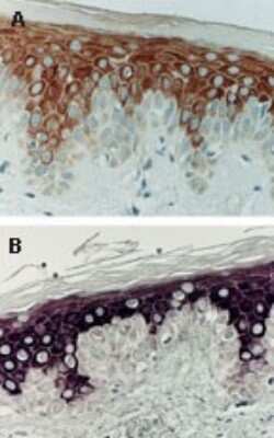 Immunohistochemistry-Paraffin: Bcl-xL Antibody [NB100-56104]