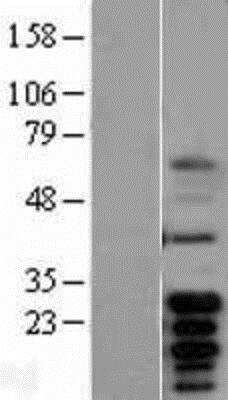 Western Blot: Bcl-xL Overexpression Lysate [NBL1-07946]