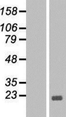 Western Blot: Bcl-xL Overexpression Lysate [NBP2-08227]