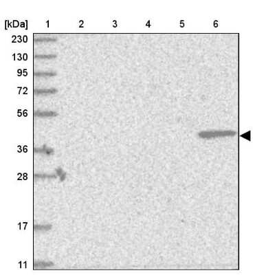 Western Blot: Bcl rambo Antibody [NBP1-90002]