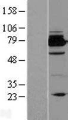 Western Blot: Bcl rambo Overexpression Lysate [NBP2-07183]