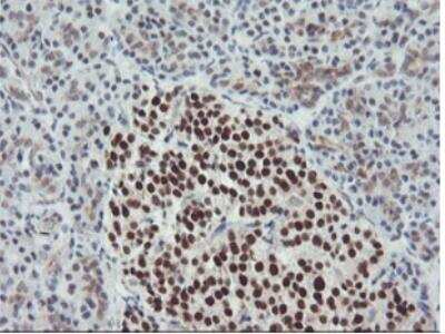 Immunohistochemistry-Paraffin: Bcl-xL Antibody (OTI4A9) [NBP1-47665]