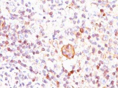 Immunohistochemistry-Paraffin: bcl-x Antibody (BX006) [NBP2-25240]