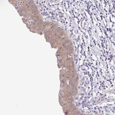 Immunohistochemistry-Paraffin: Bcl-xL Antibody [NBP2-38262]