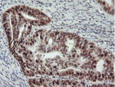 Immunohistochemistry-Paraffin: Bcl-xL Antibody (OTI4A9) - Azide and BSA Free [NBP2-70247]