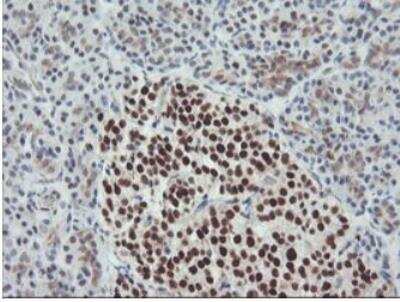 Immunohistochemistry-Paraffin: Bcl-xL Antibody (OTI4A9) - Azide and BSA Free [NBP2-70247]