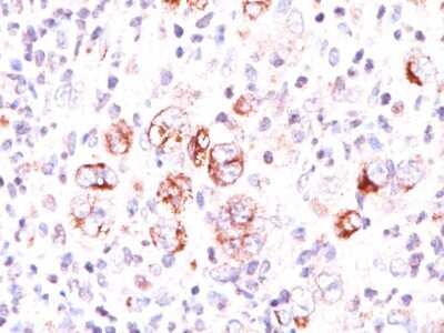 Immunohistochemistry-Paraffin: bcl-x Antibody (SPM165) - Azide and BSA Free [NBP2-34743]