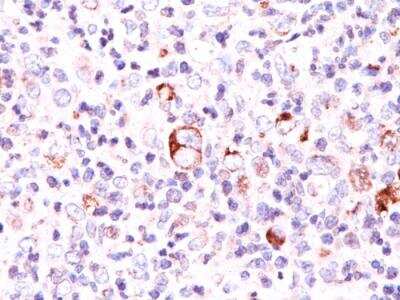 Immunohistochemistry-Paraffin: bcl-x Antibody (SPM165) [NBP2-32810]