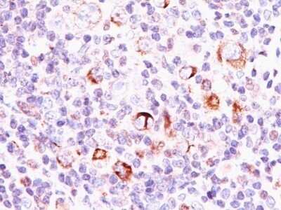 Immunohistochemistry-Paraffin: bcl-x Antibody (SPM337) - Azide and BSA Free [NBP2-47814]