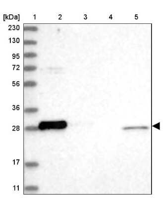 Western Blot: Bcl-xL Antibody [NBP2-38262]