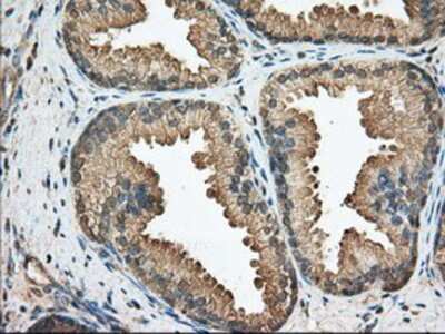 Immunohistochemistry-Paraffin: Bcl-10 Antibody (OTI4A8) [NBP2-02597]