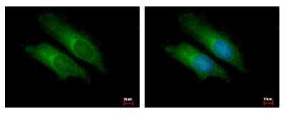 Immunocytochemistry/ Immunofluorescence: Bcl-10 Antibody [NBP2-15554]