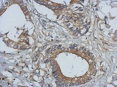 Immunohistochemistry-Paraffin: Bcl-10 Antibody [NBP2-15554]