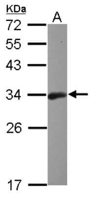 Western Blot: Bcl-10 Antibody [NBP2-15554]