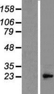 Western Blot: Bcl-10 Overexpression Lysate [NBP2-07935]