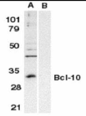 Western Blot: Bcl-10 Antibody Blocking Peptide [NBP1-76882PEP]