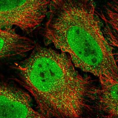 Immunocytochemistry/ Immunofluorescence: Bcl3 Antibody [NBP2-57127]