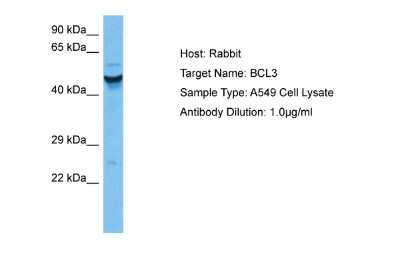 Western Blot: Bcl3 Antibody [NBP2-87069]